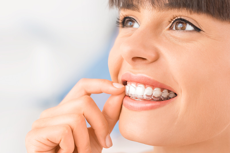 Invisalign® Go in Reno