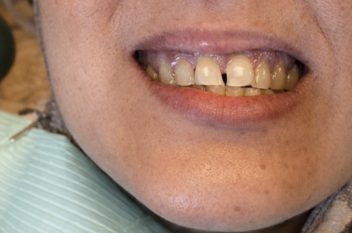 Screen Shot 2026 04 14 at 2.58.39 PM - Futch Dental