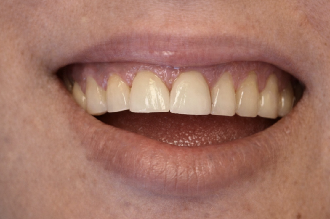Screen Shot 2026 04 14 at 2.58.48 PM - Futch Dental