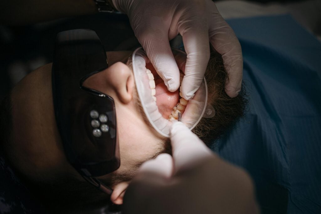 gum infection futch dental - Futch Dental