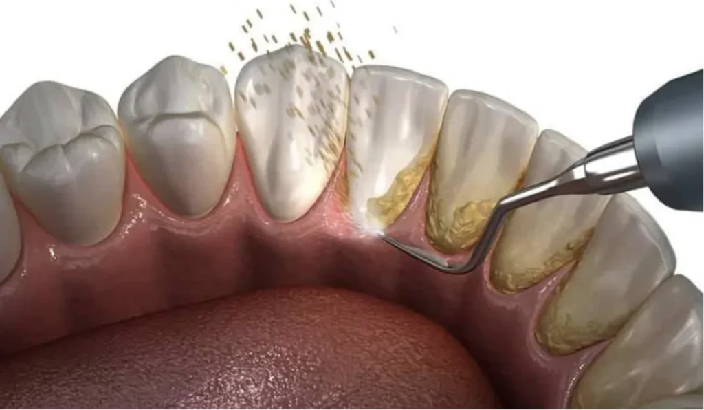 image 21 - Futch Dental