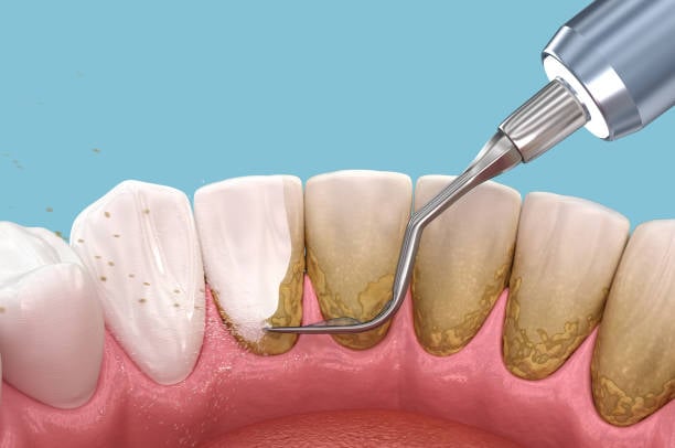 periodical care service futch dental