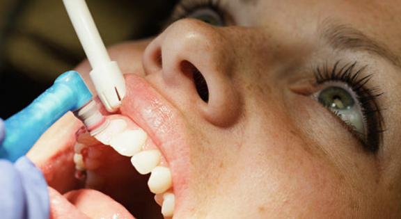 Healthy Mouth Cleaning