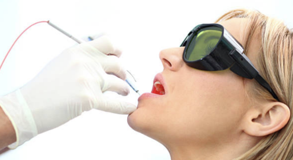 Laser Periodontal Therapy (1)